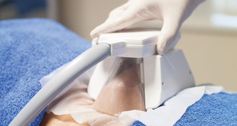 How Fat Freezing and HIFU Work Together? 2 Multiple Areas in One Session HIFU and Fat Freezing Walsall