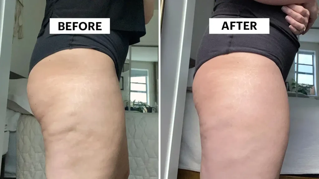 Do Toning Exercise Walsall Really Tackle Cellulite?