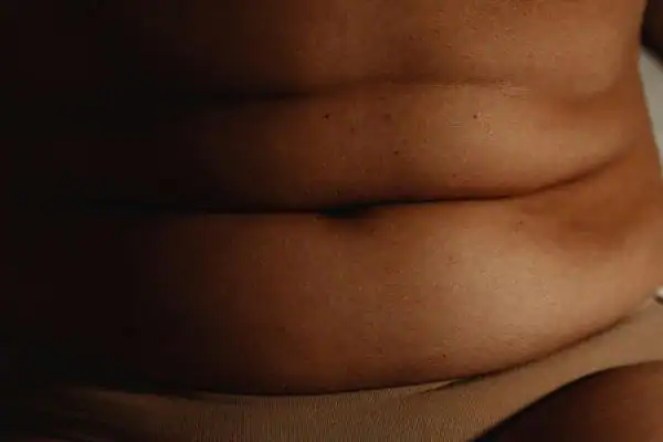 The Hidden Connection: How Stress Shapes Your Fitness and Body Composition 3 image of what stress can do on the stomach area and how Lipo 360 Walsall can help to change your body shape.
